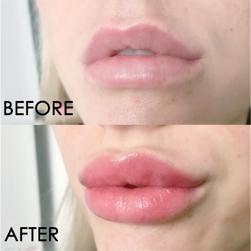 Siero per la cura delle labbra - Lip Gloss Plumping recensione e prezzo